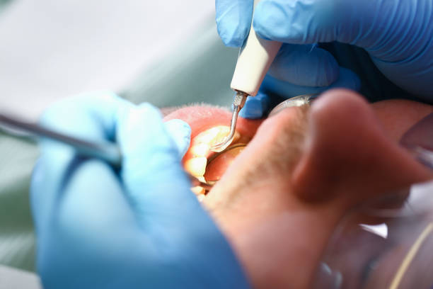 Best Emergency Dental Services for Seniors in Rden City, GA