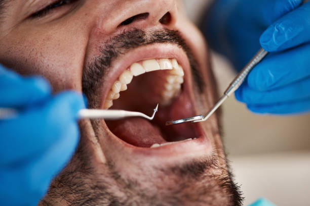 Best Mobile Emergency Dentist in Rden City, GA
