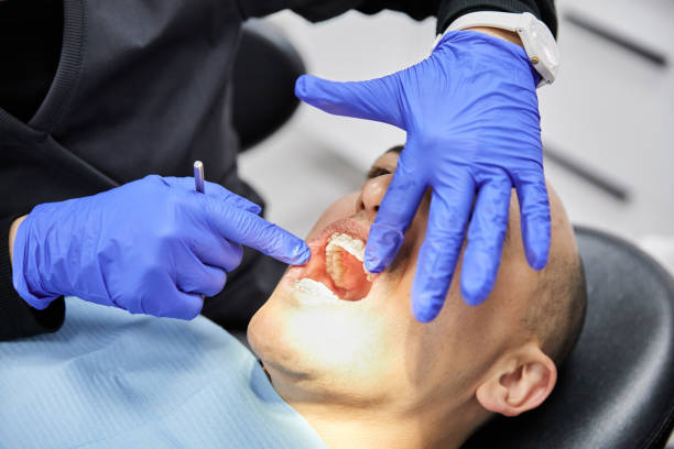 Best Weekend Emergency Dentist in Rden City, GA